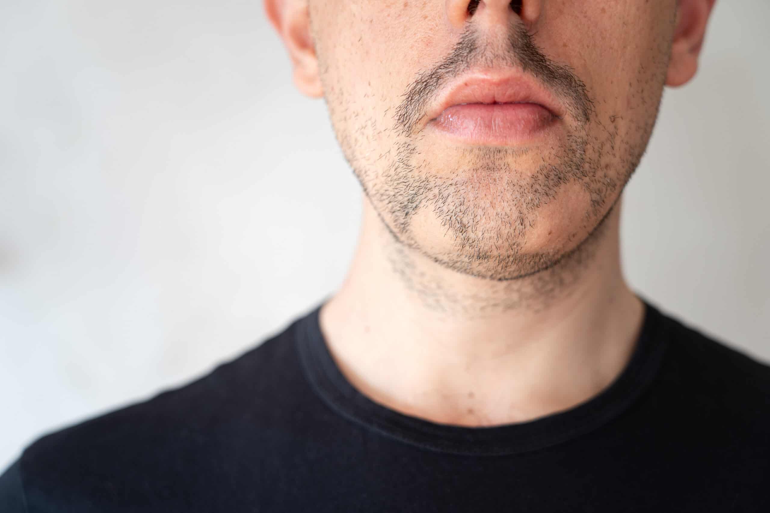 Can't grow a full beard? Try another facial hair option.