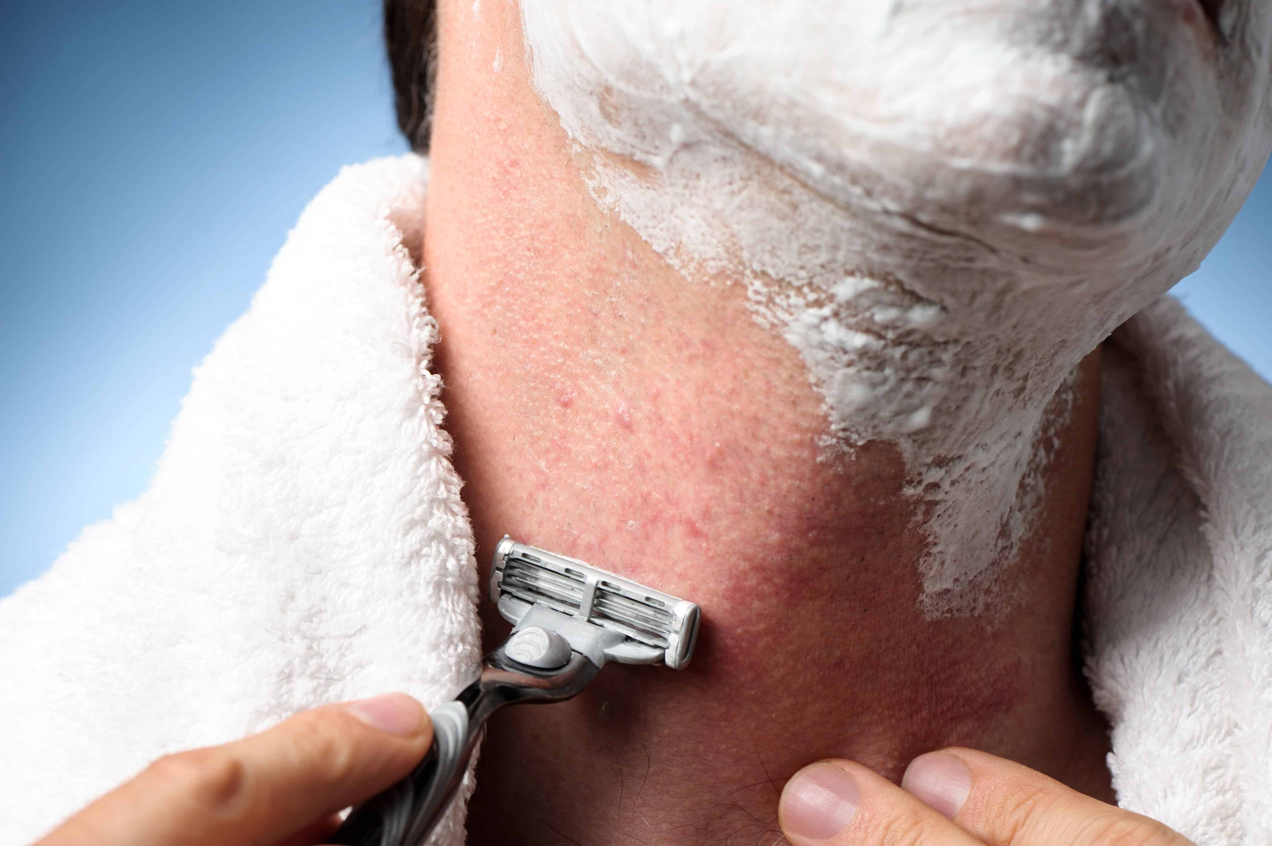 Is shaving bad for your skin?